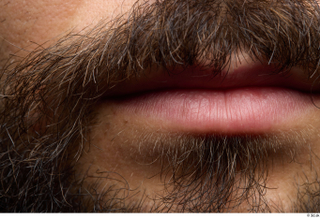 HD Face Skin Turgen chin face lips mouth skin pores…